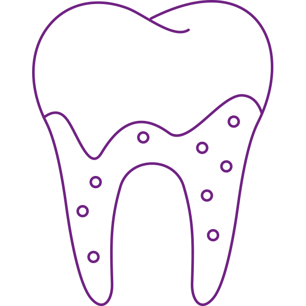 Wurzelkanalbehandlungen
